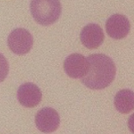 免疫介在性溶血性貧血 (IMHA)