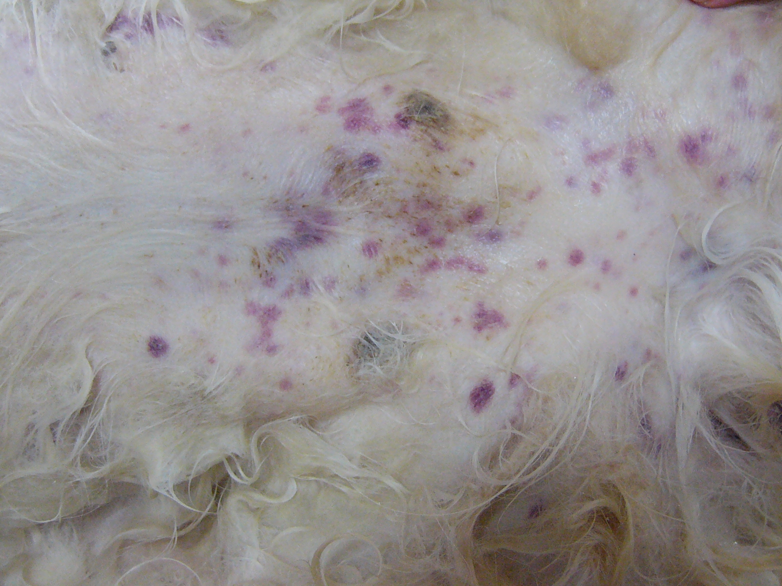 免疫介在性血小板減少症 (ITP)