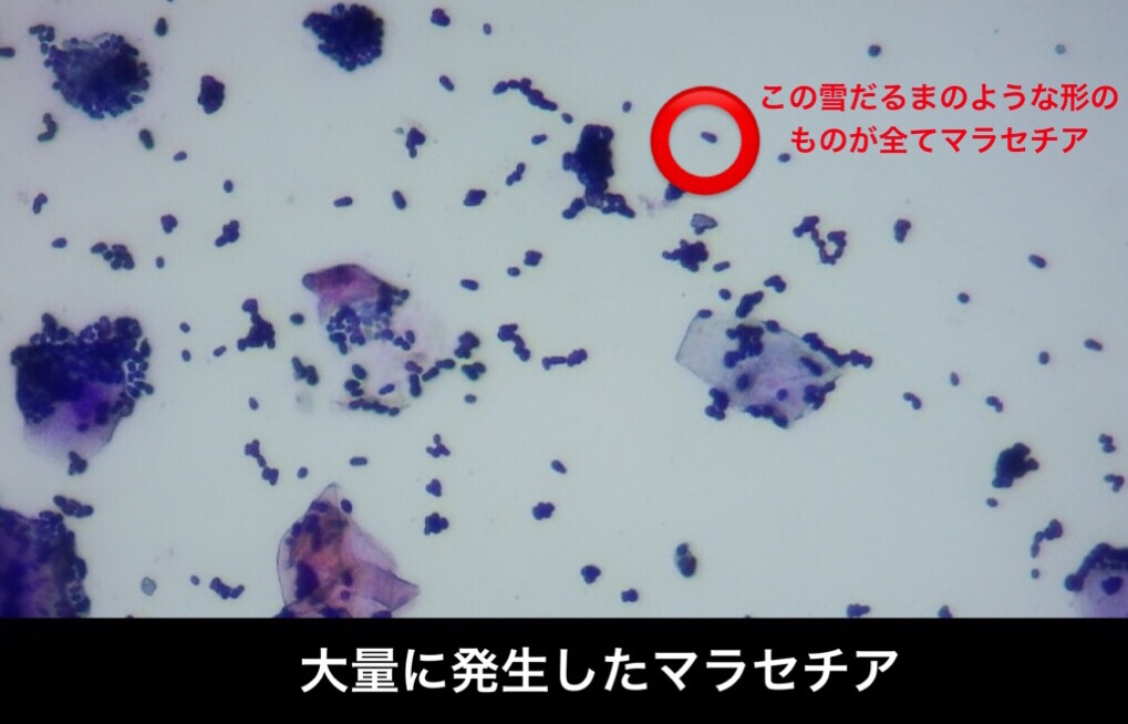 大量に発生したマラセチア