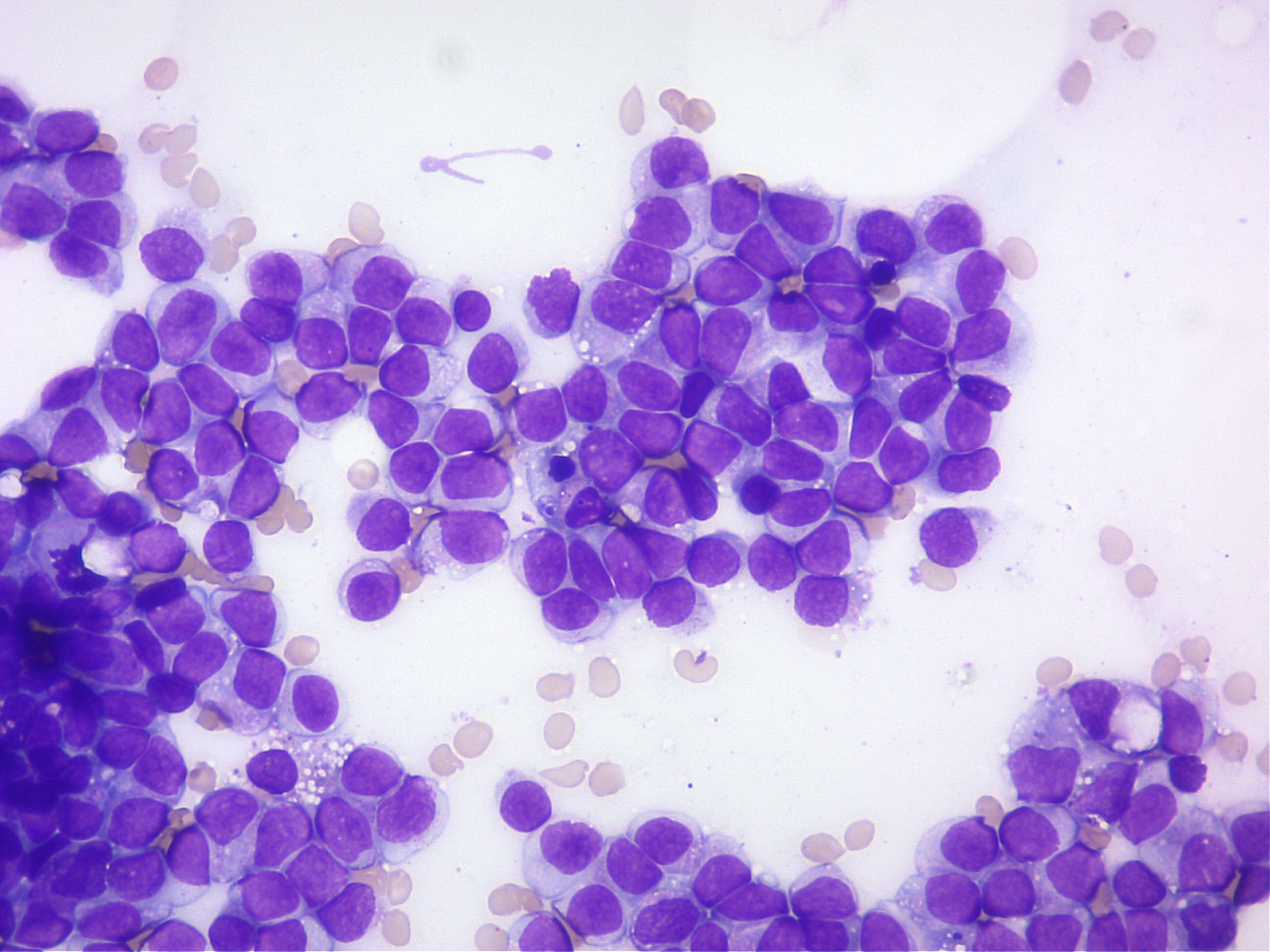 リンパ腫の細胞診の顕微鏡画像