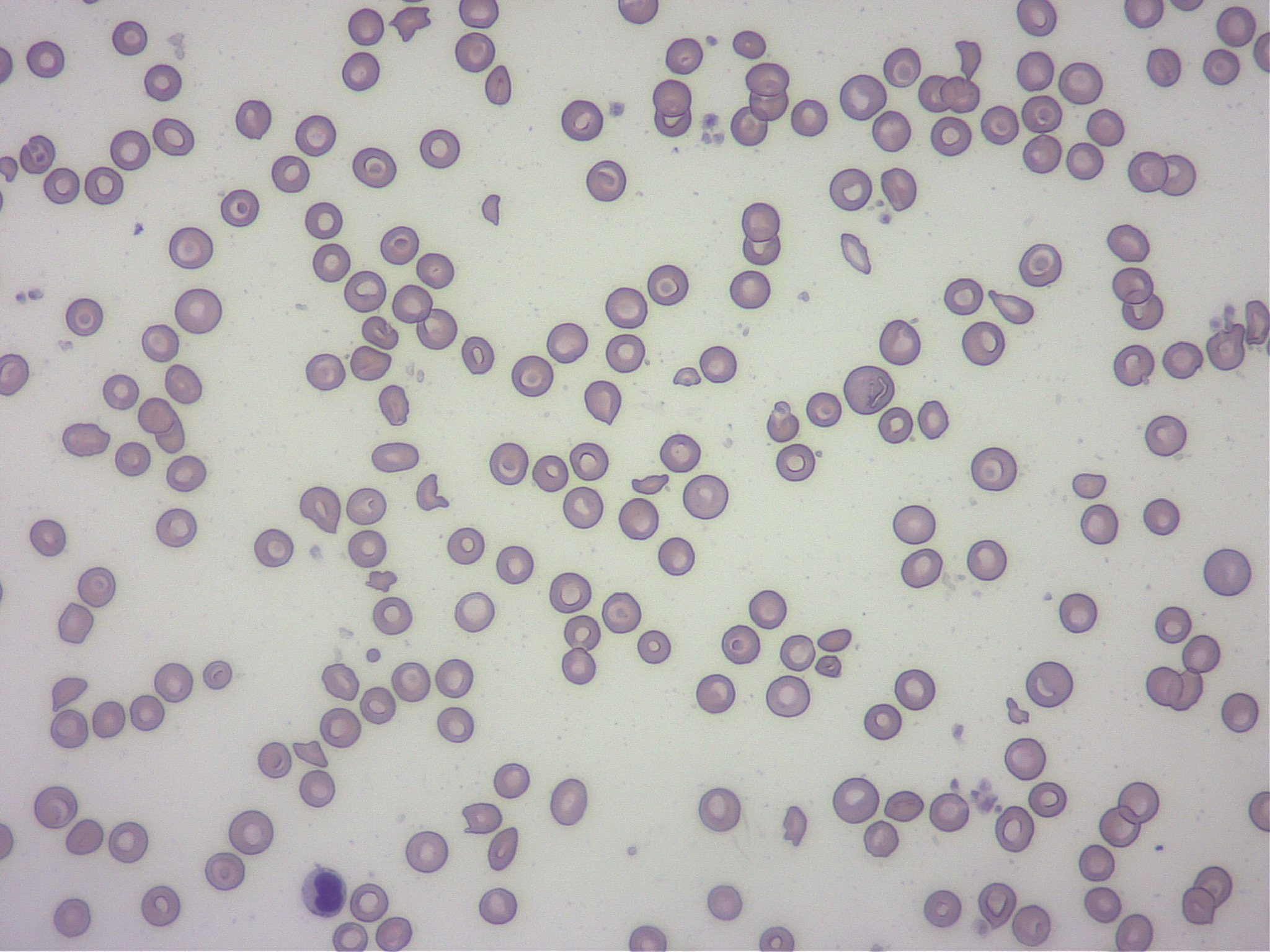 破砕赤血球の顕微鏡画像