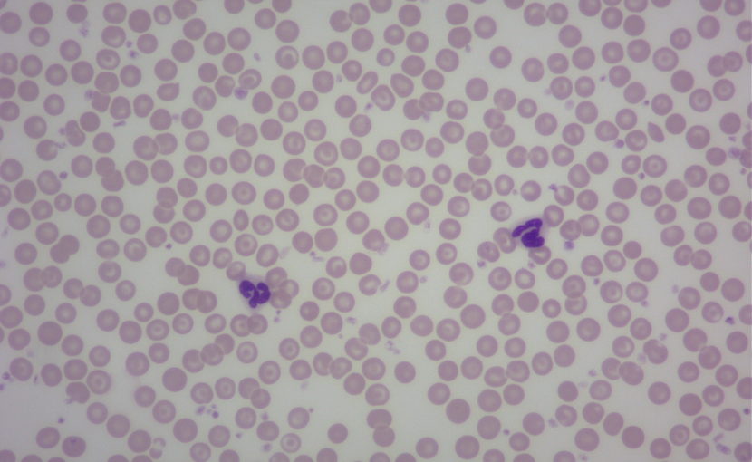 好中球の顕微鏡画像