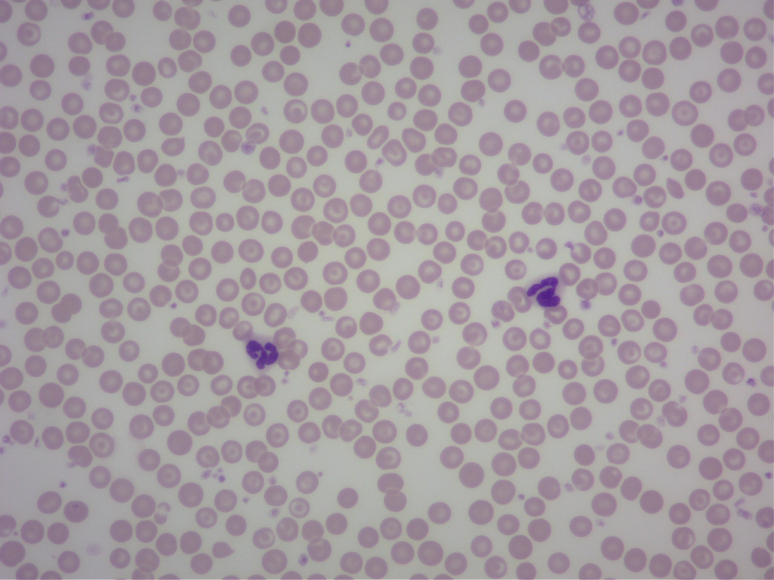 好中球の顕微鏡画像