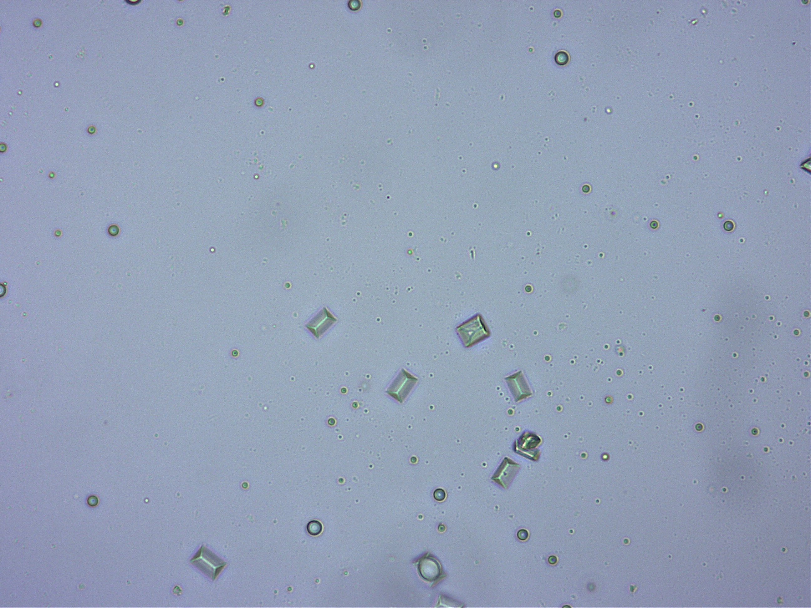 ストルバイト結晶