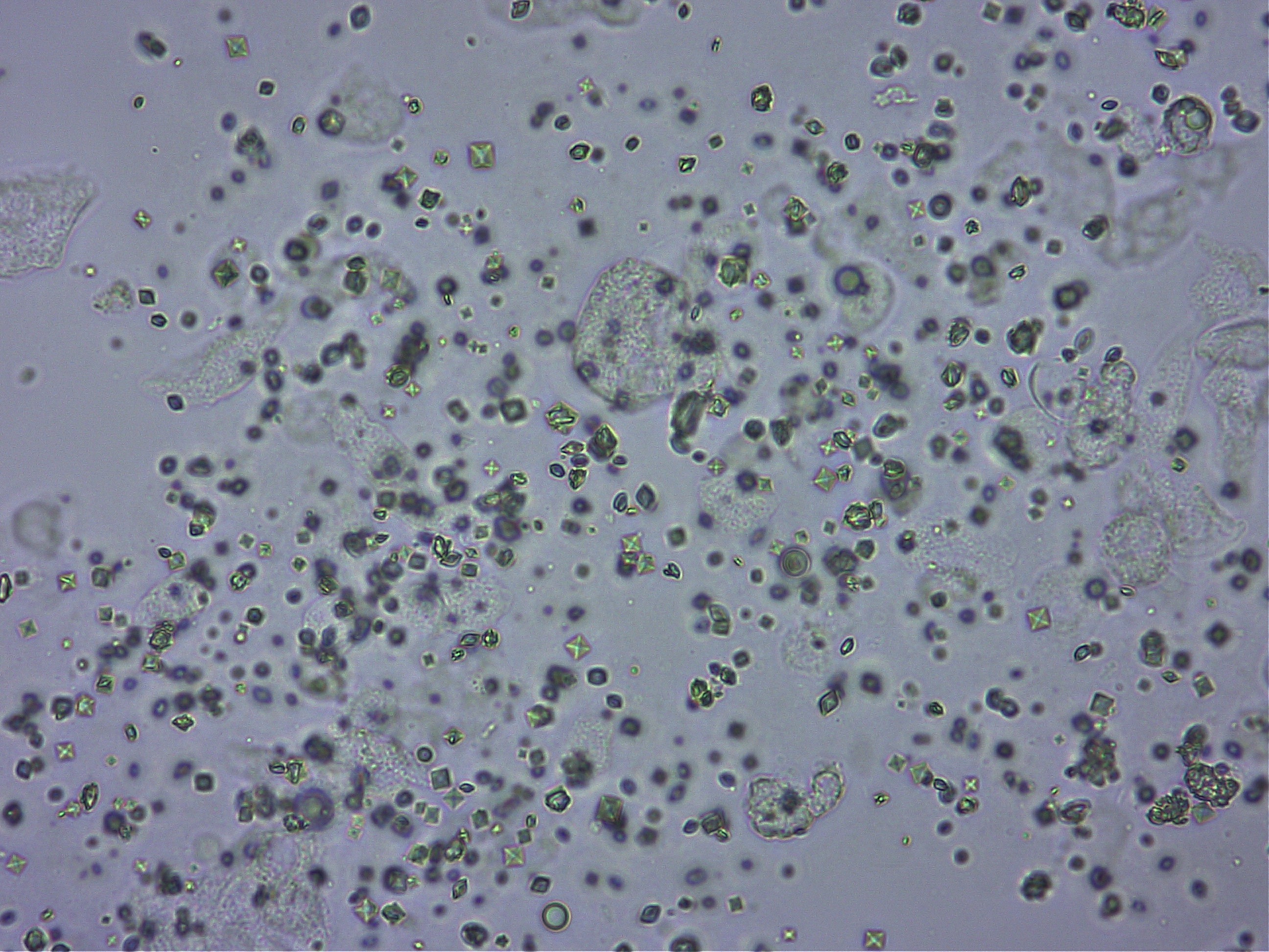 シュウ酸カルシウム