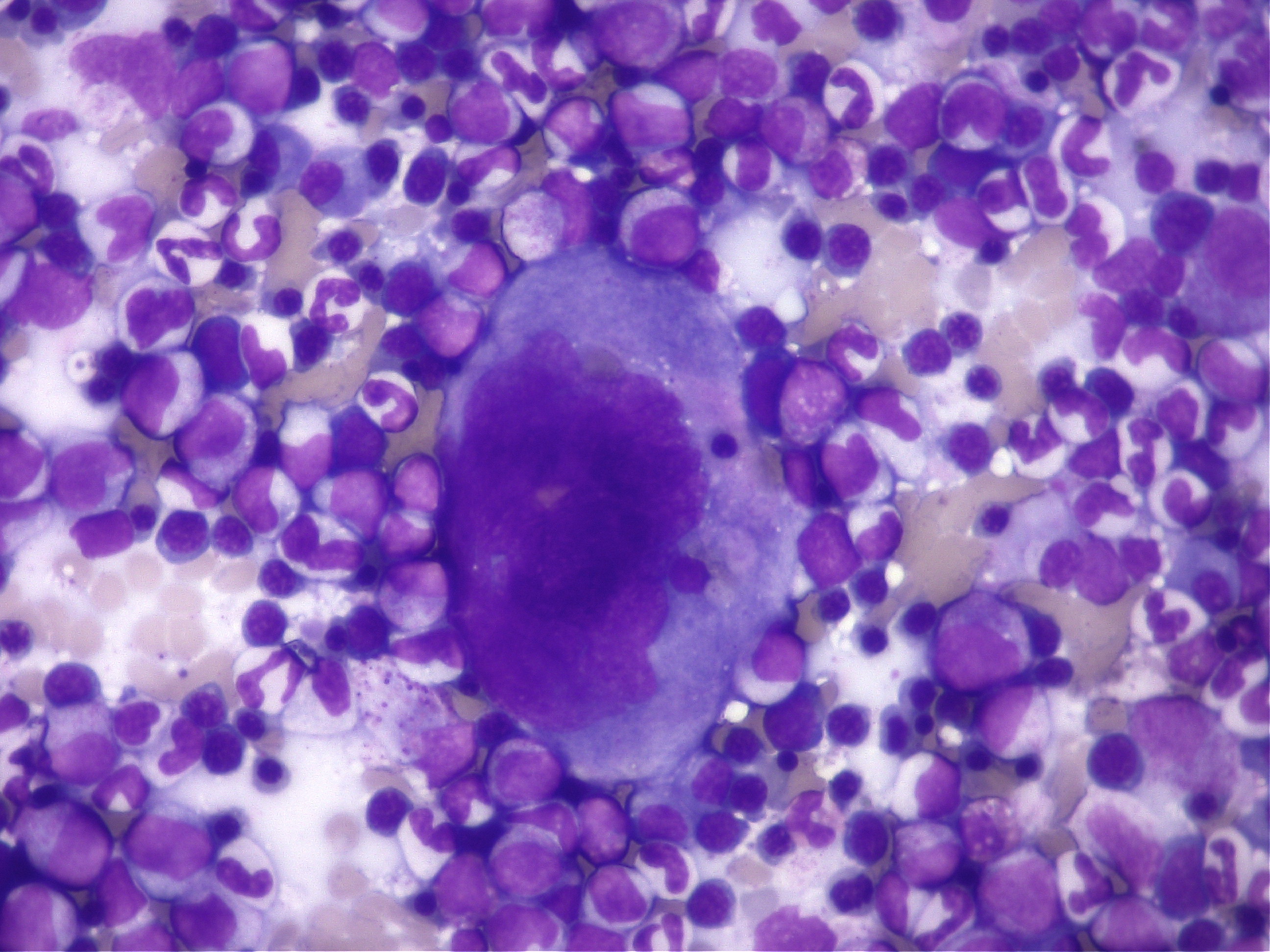 骨髄検査の顕微鏡画像