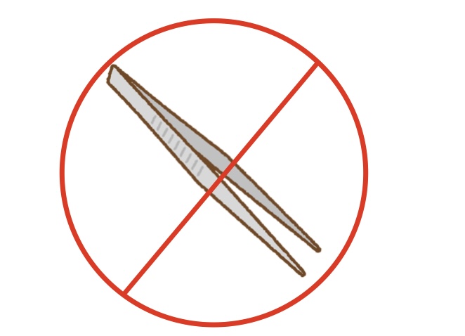 ピンセットはNG