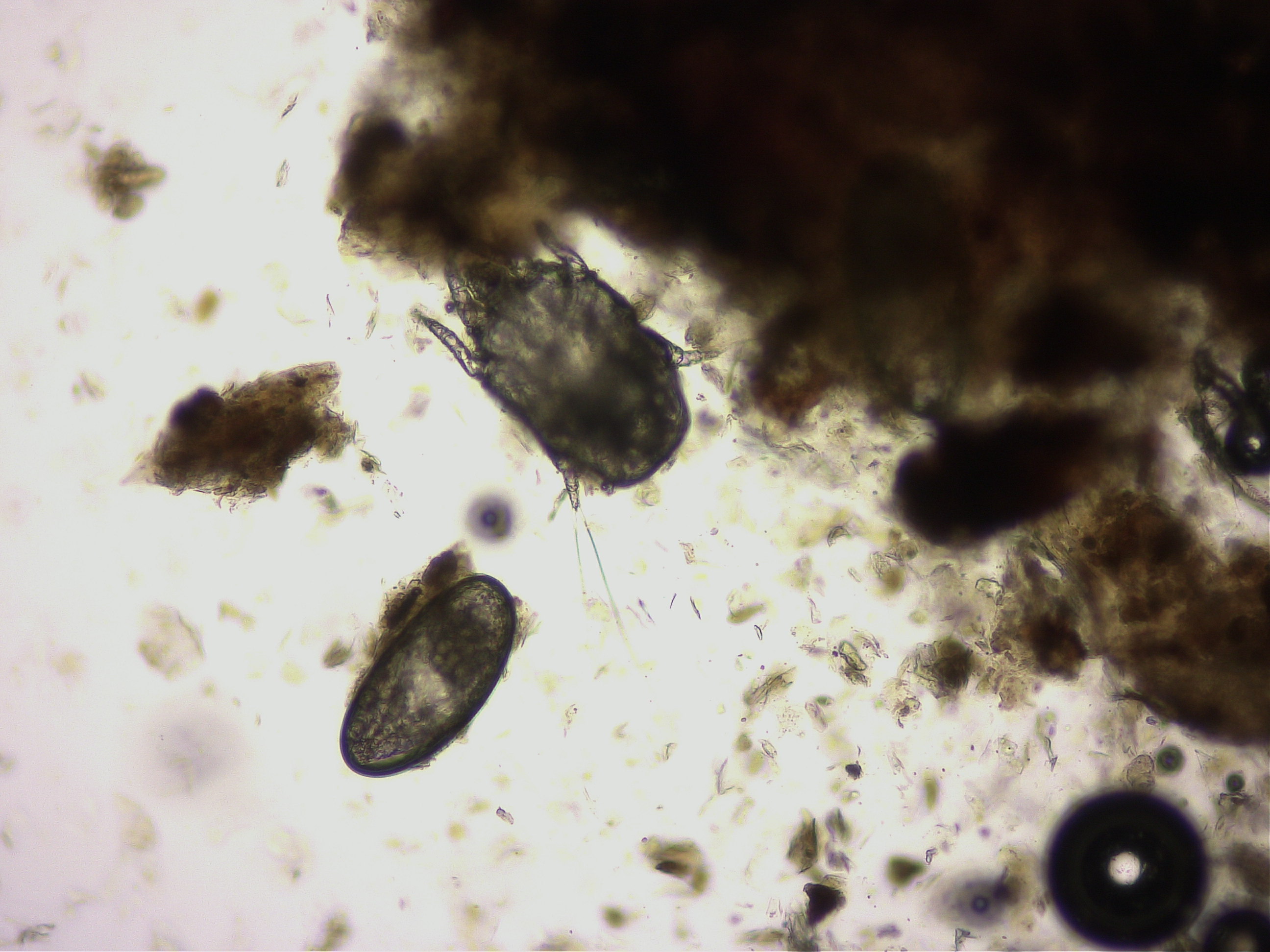 耳ヒゼンダニの画像