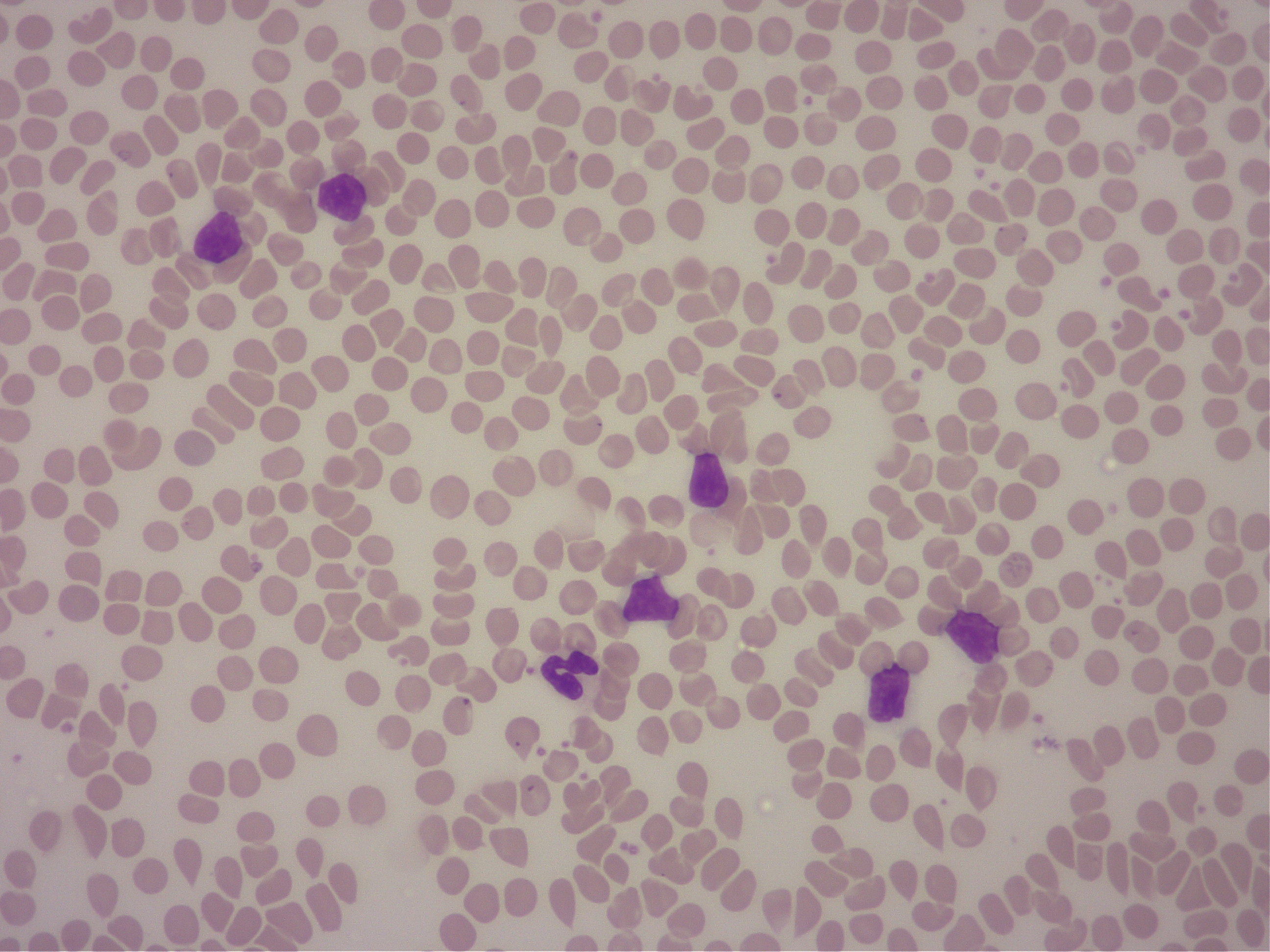 血液塗沫の顕微鏡検査画像