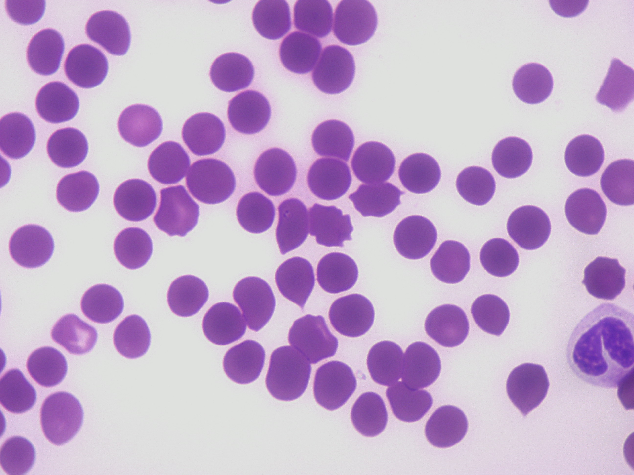 バベシアの虫体がいる血液塗沫検査の画像