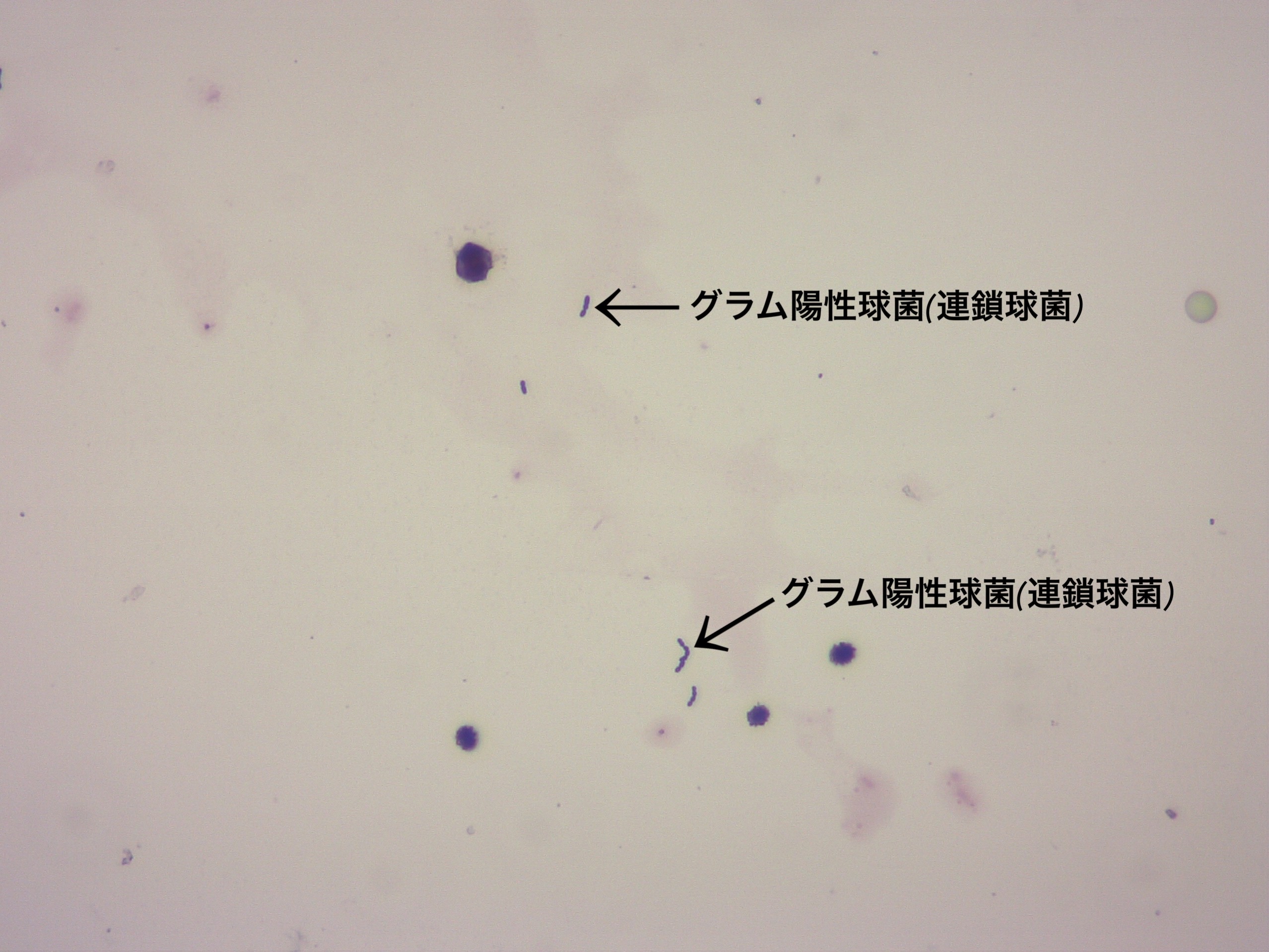 尿のグラム染色検査の顕微鏡画像