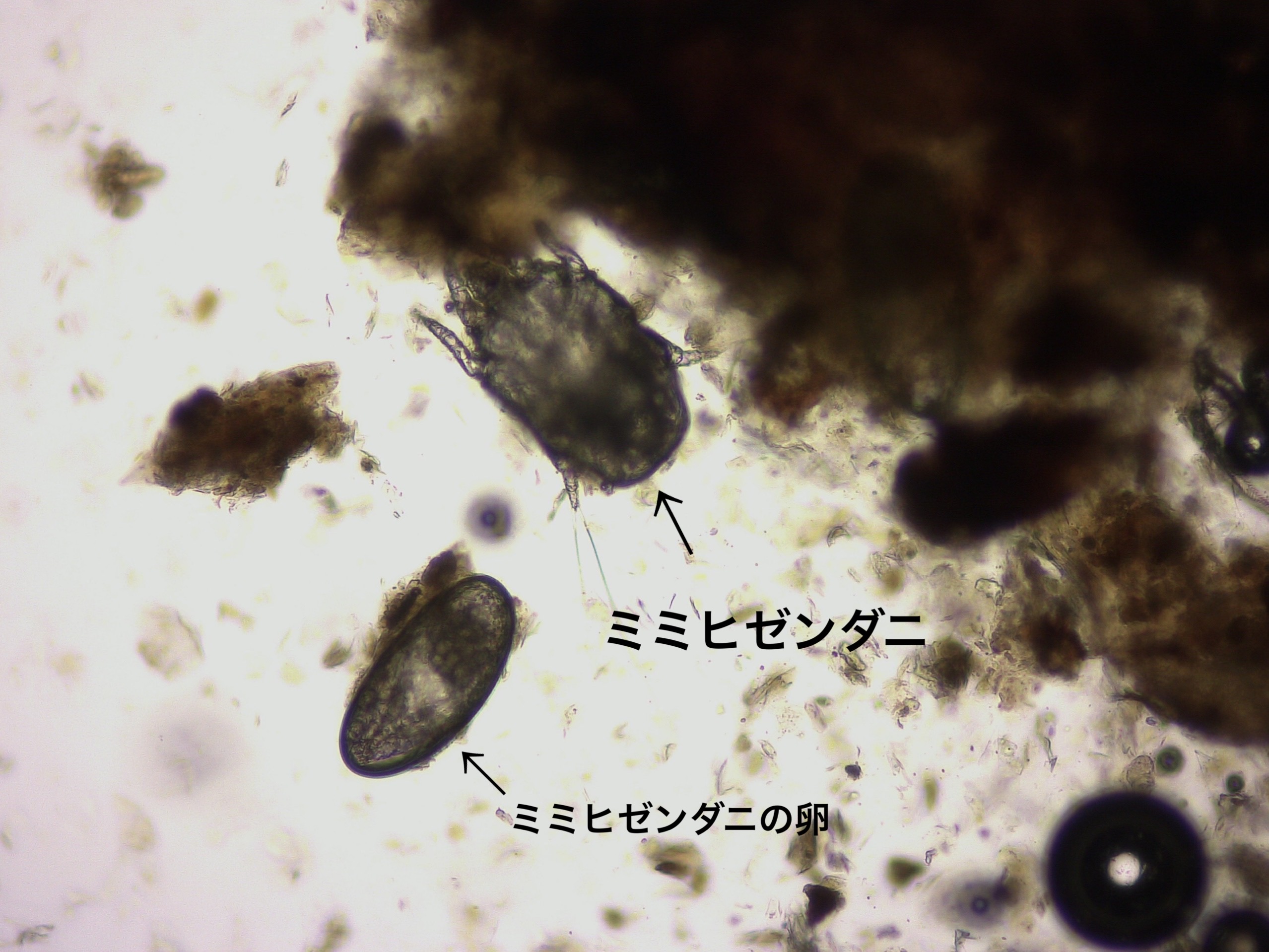 ミミヒゼンダニの顕微鏡画像