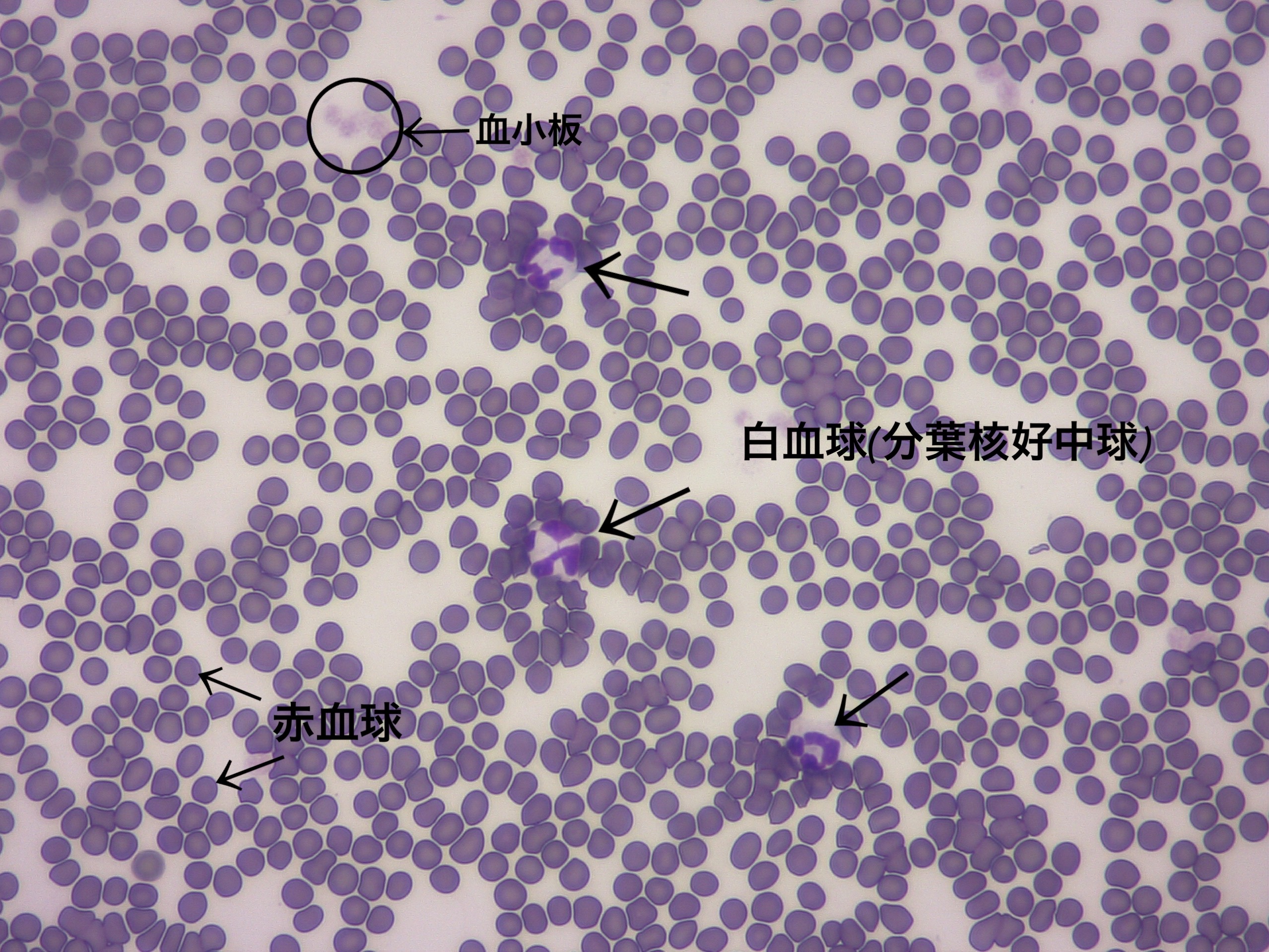 血液塗沫の顕微鏡画像