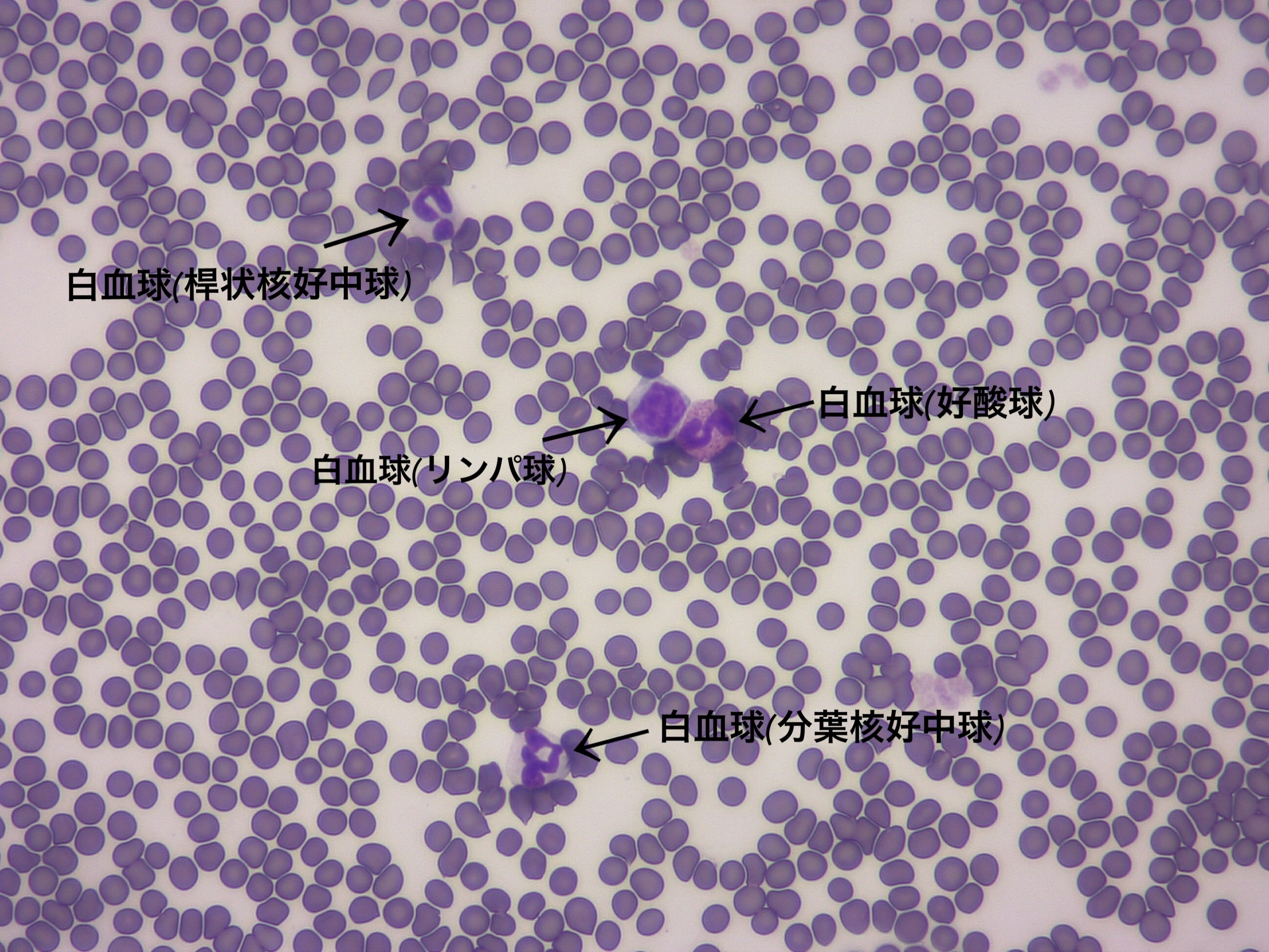 血液塗沫の顕微鏡画像