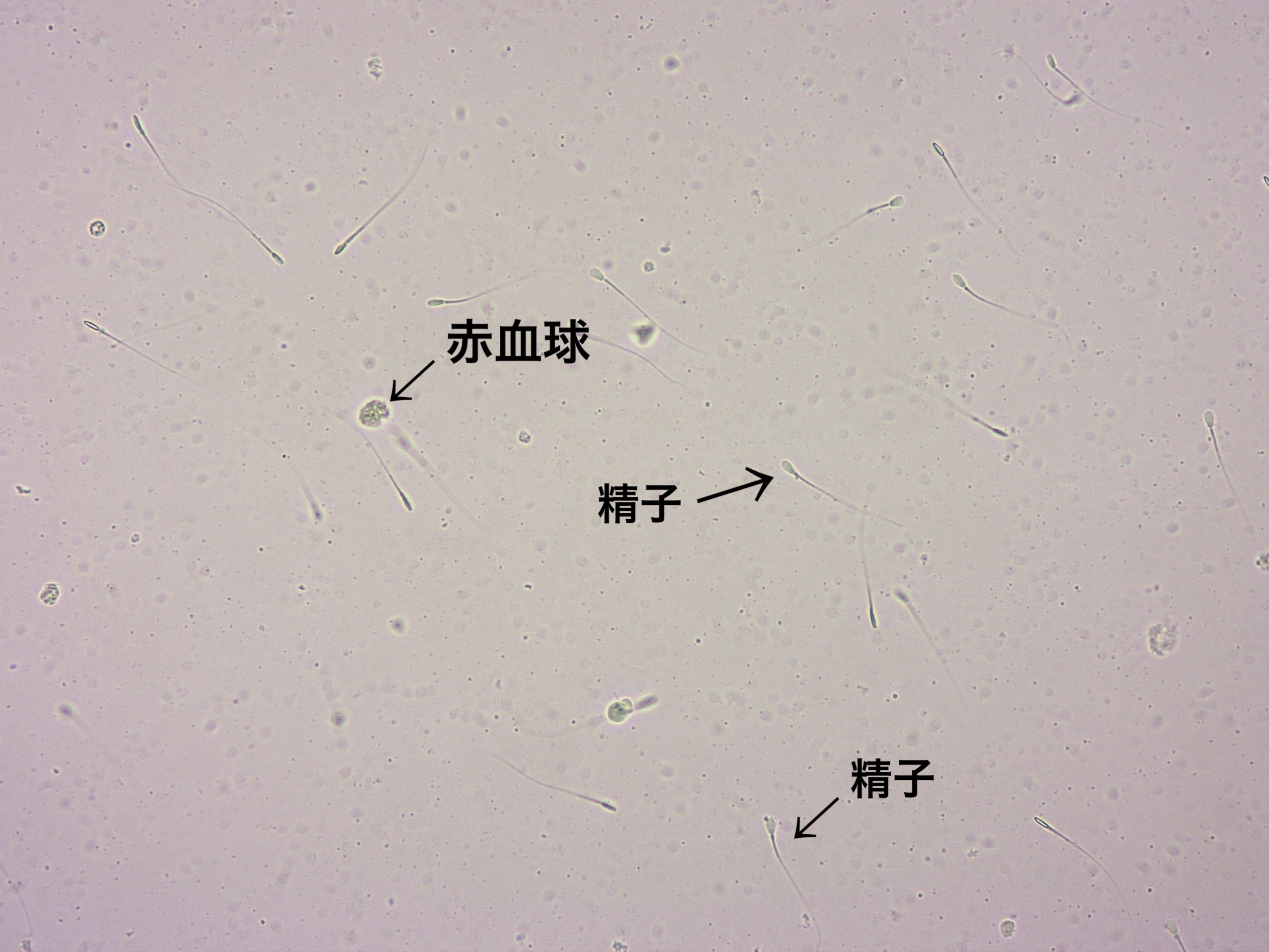 尿の顕微鏡画像