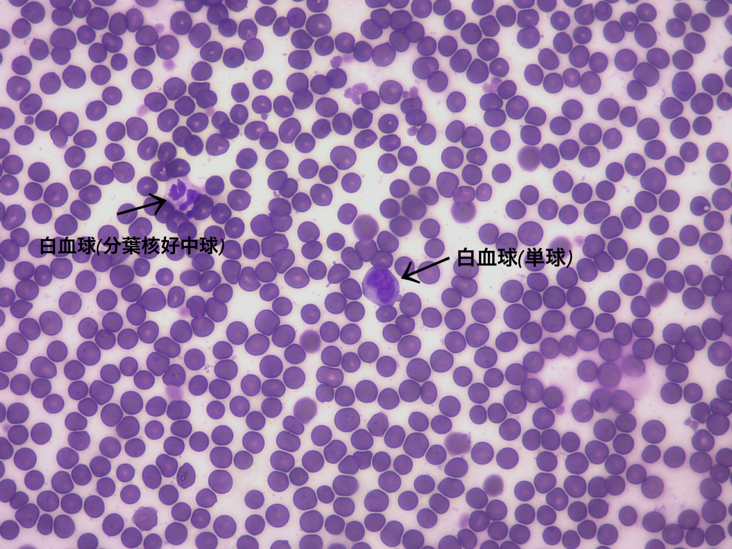 血液塗沫の顕微鏡画像