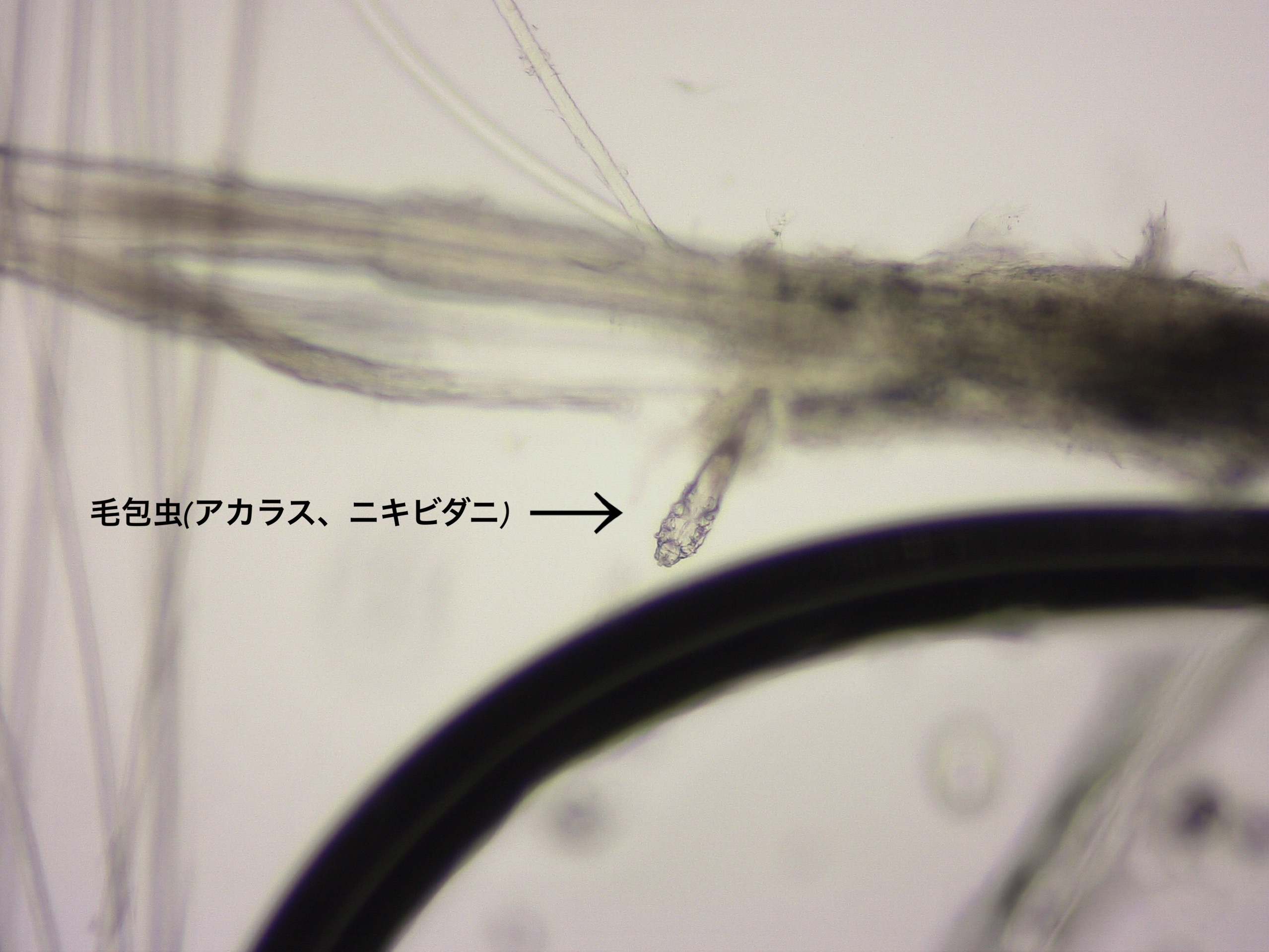 毛包虫の顕微鏡画像