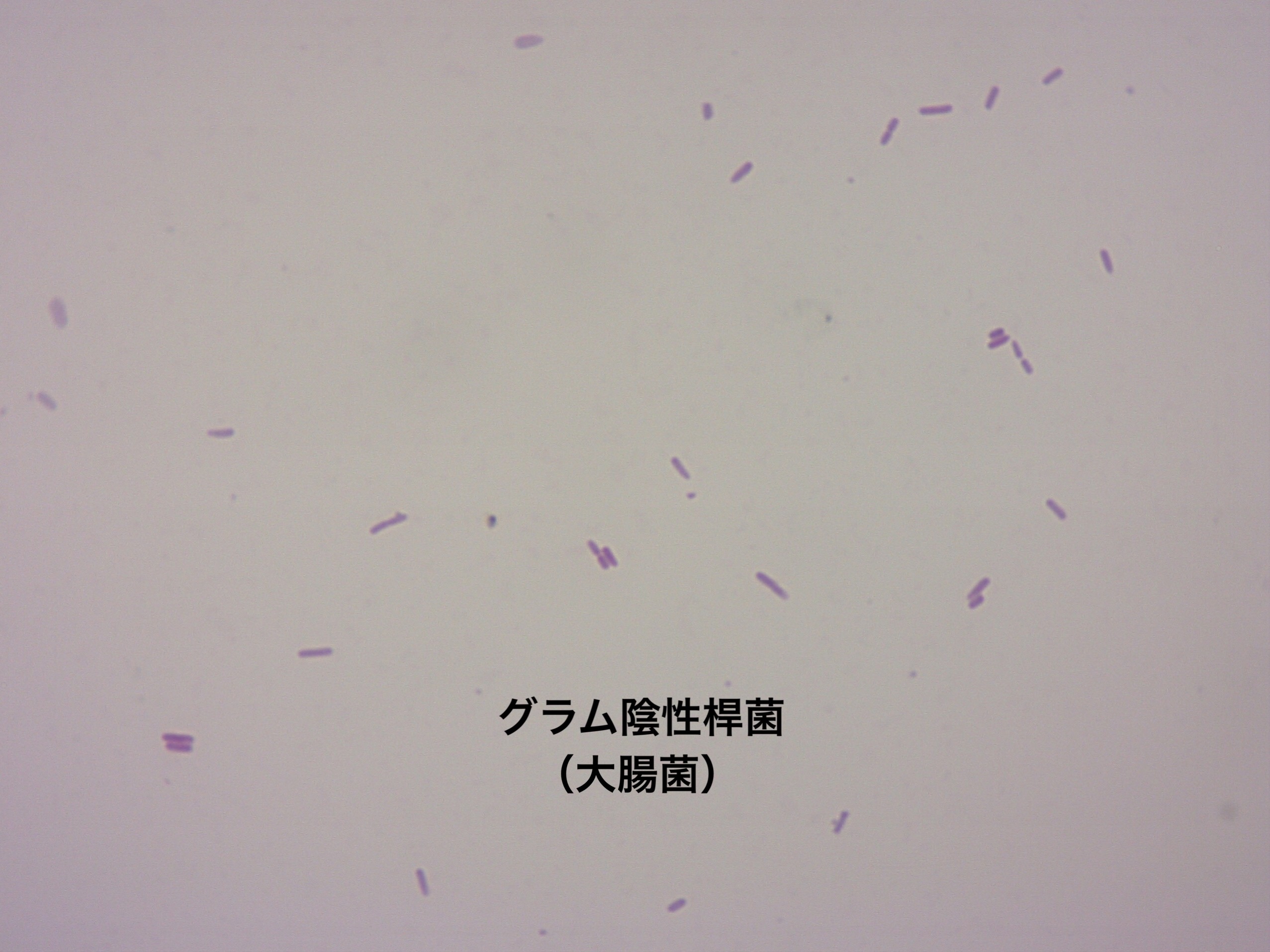 尿のグラム染色検査の顕微鏡画像