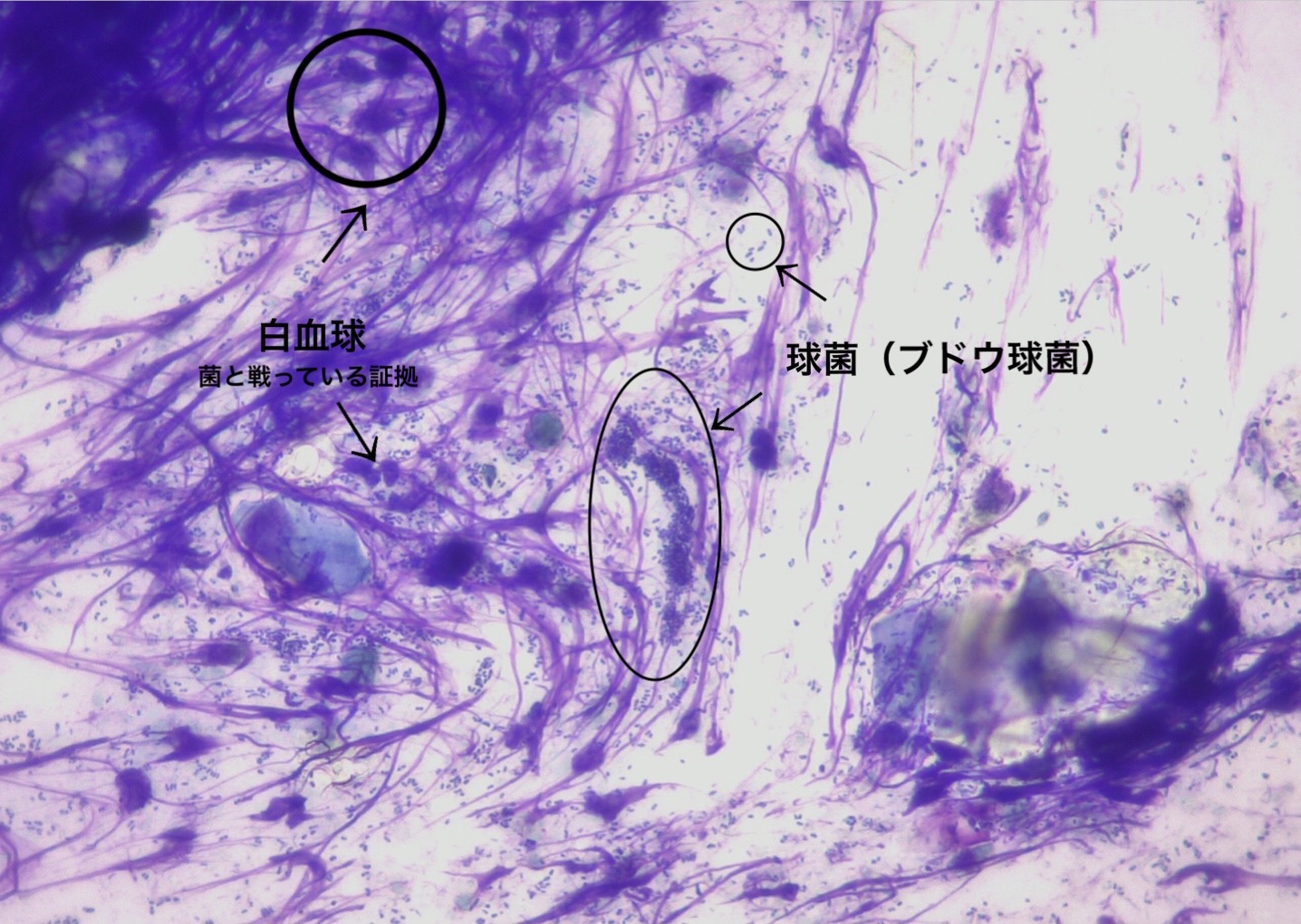 膿皮症の顕微鏡画像