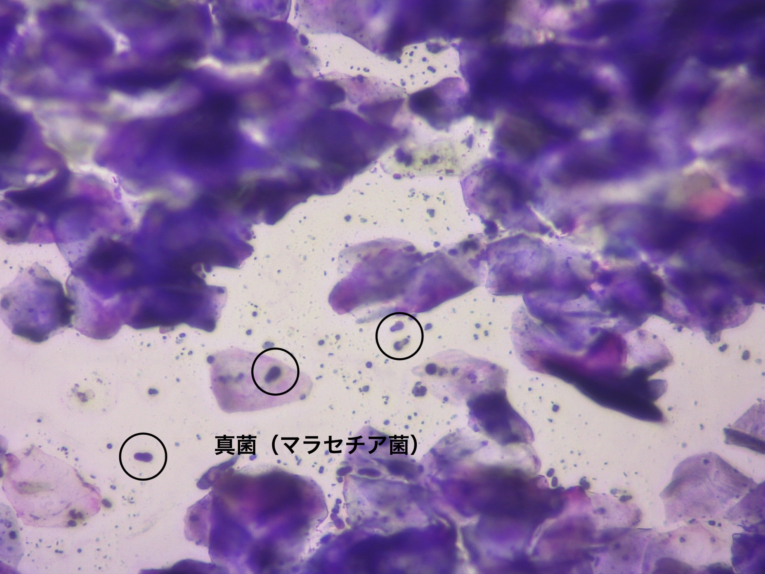 マラセチアの顕微鏡画像