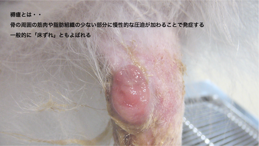 褥瘡