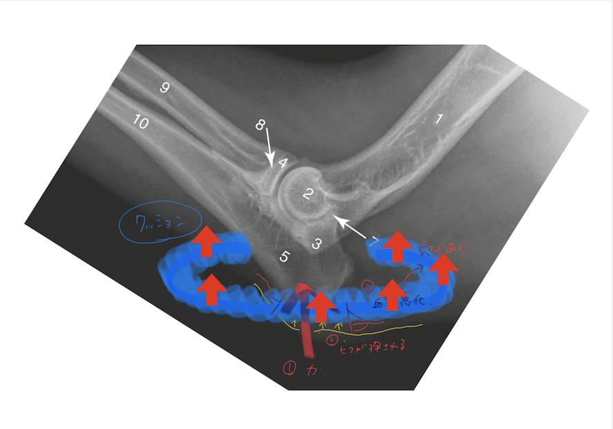 褥瘡が起こりやすい場所の圧を分散させる