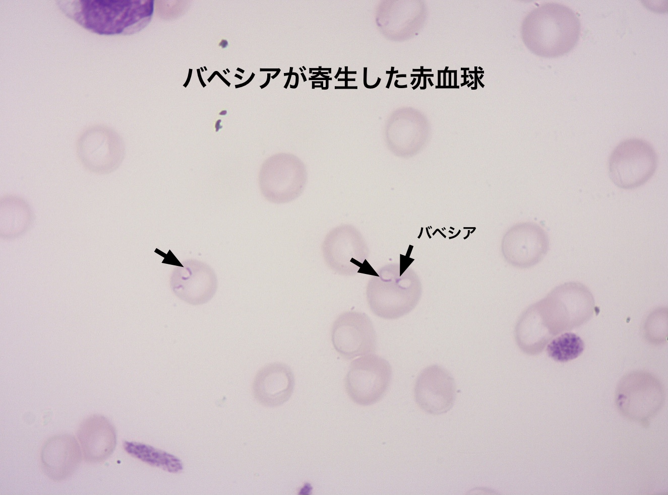 バベシアが寄生した赤血球