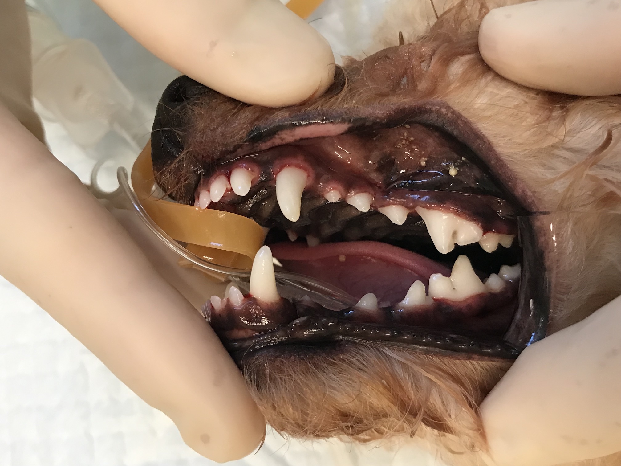 歯石除去した後の口の中