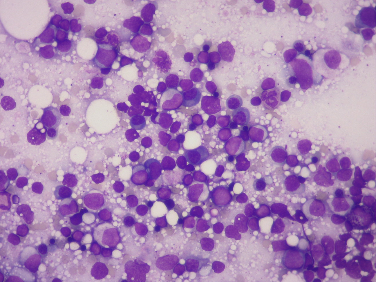 骨髄検査の顕微鏡画像