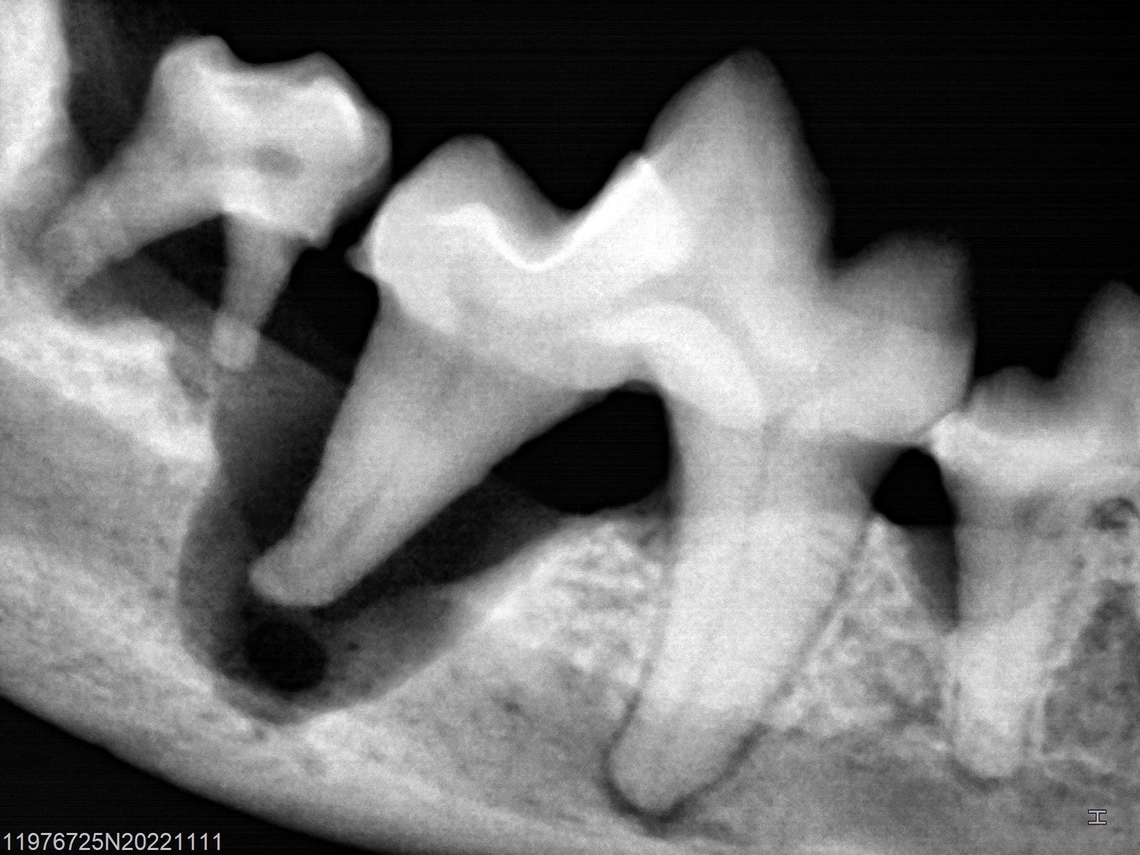 歯周病で下顎が溶けているレントゲン画像