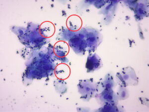 マラセチアの顕微鏡画像