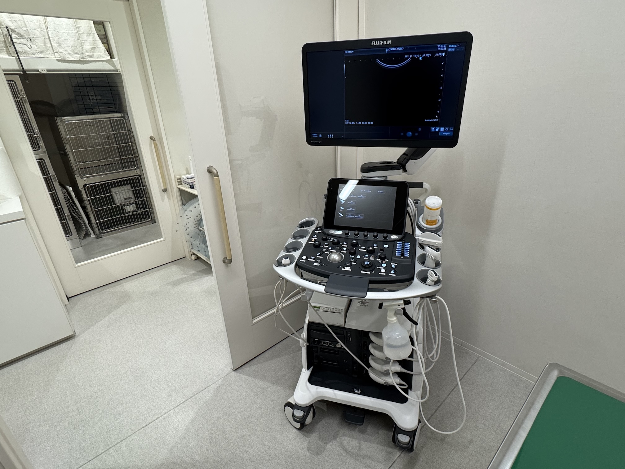 超音波診断装置